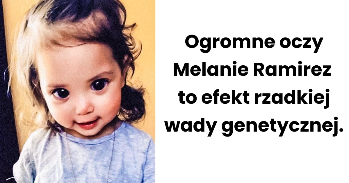 Read more about the article 14 osób, które osiągnęły sławę z powodu niecodziennego wyglądu