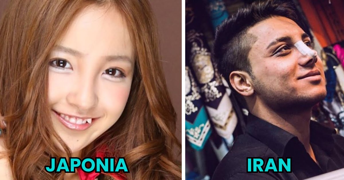 Read more about the article 8 dziwnych rzeczy, które w pewnych krajach są postrzegane jako seksowne