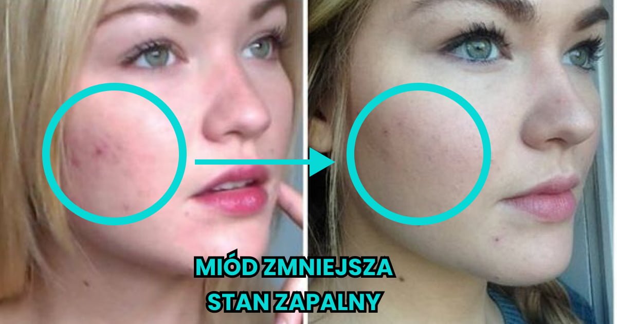 Read more about the article 10 domowych sztuczek dotyczących pielęgnacji ciała, dzięki którym uzyskasz piękny i naturalny wygląd