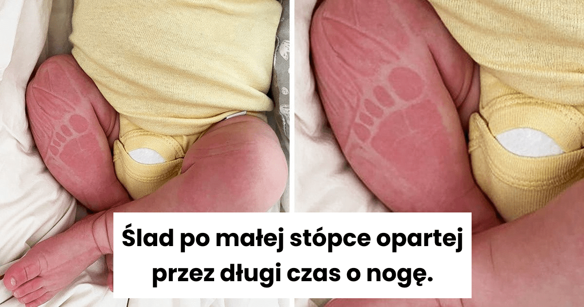 Read more about the article 17 wzruszających zdjęć, które potwierdzają, że w życiu piękne są tylko chwile