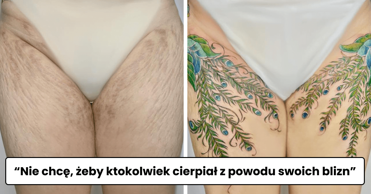 Read more about the article 36 kreatywnych tatuaży, które idealnie zatuszowały blizny i znamiona