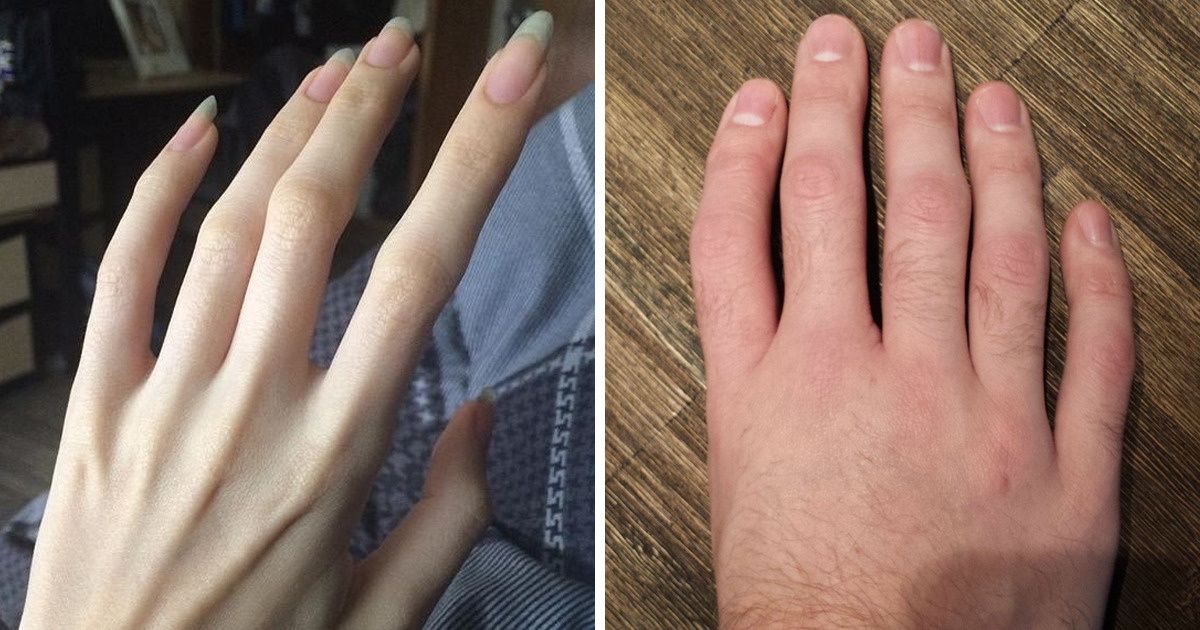 Read more about the article 9 zaskakujących ludzkich cech fizycznych, które odróżniają ich od innych